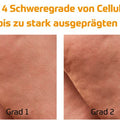 GUAM Algenfango gegen Cellulite zeigt die 4 Schweregrade von Cellulite mit Bildvergleich Grad 0 glatte Haut Grad 1 leichte Dellen sichtbar bei Druck Grad 2 Cellulite sichtbar ohne Druck im Stehen Grad 3 stark ausgeprägte Dellen sichtbar im Stehen und Liegen ideal zur Verdeutlichung der Unterschiede zwischen den Stadien von Orangenhaut für Anti Cellulite Behandlung Hautstraffung und Mikrozirkulationsförderung. Naturpräparate Dieterich